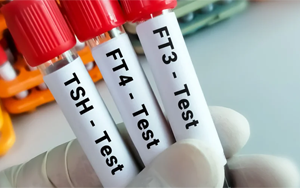 總及游離甲狀腺素（TT4及FT4）-磁微?；瘜W(xué)發(fā)光法（AE/AP）解決方案（雙抗體夾心法）