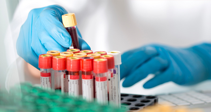 血氨檢測(cè) 血氨檢測(cè)