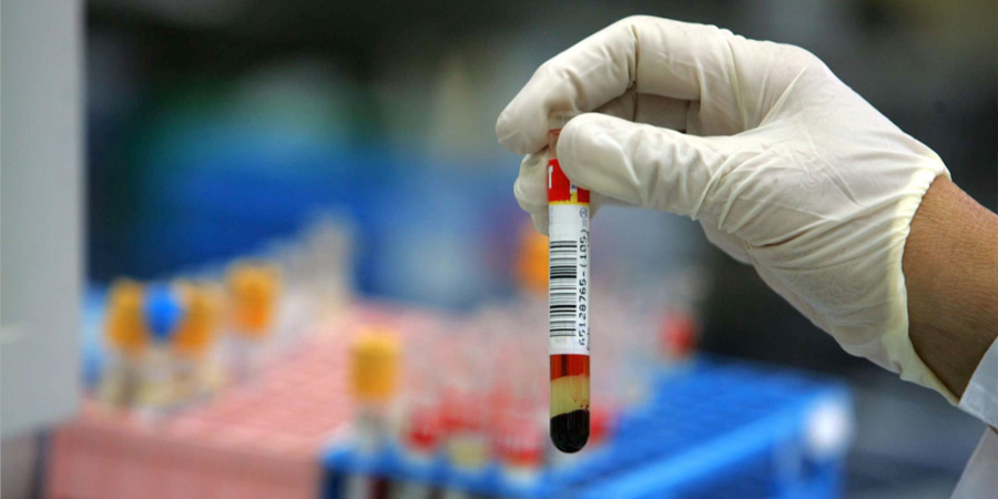 前蛋白檢測(cè) 前蛋白檢測(cè)