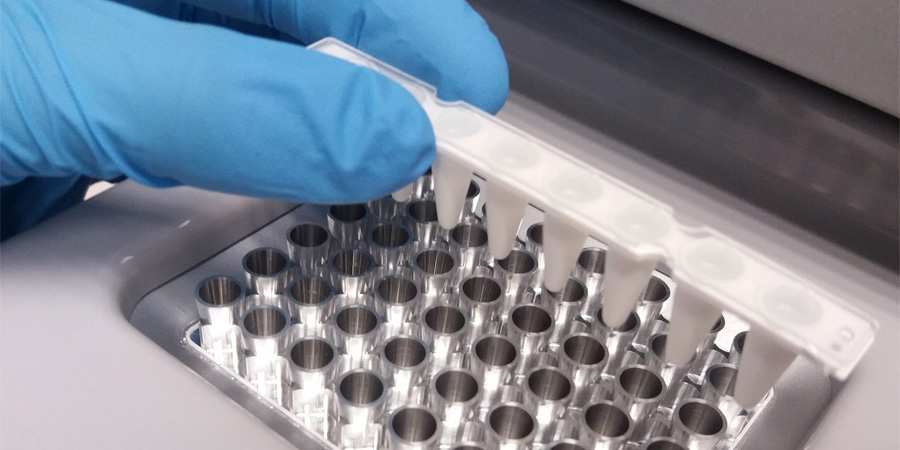 銅藍(lán)蛋白檢測(cè) 銅藍(lán)蛋白檢測(cè)