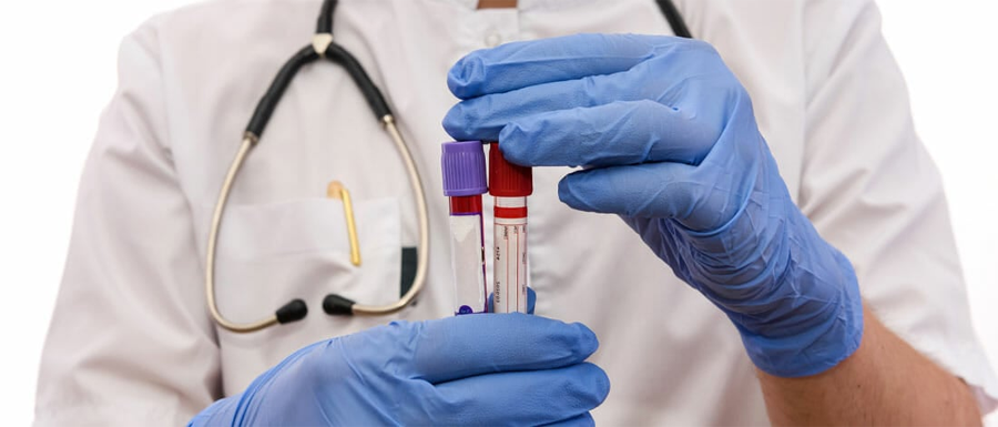 肌酸激酶MB檢測 肌酸激酶MB檢測