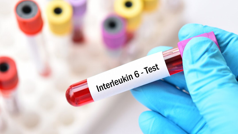 IL-6磁微?；瘜W(xué)發(fā)光熒光免疫層析